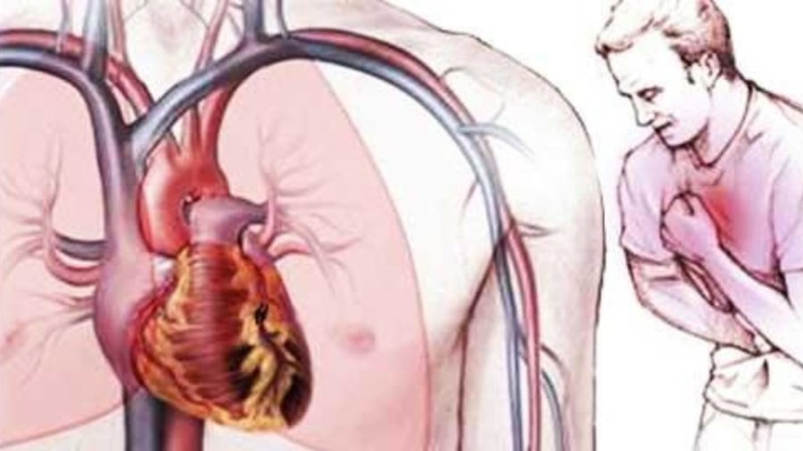 Tim là bộ phận cơ thể hiếm khi bị ung thư