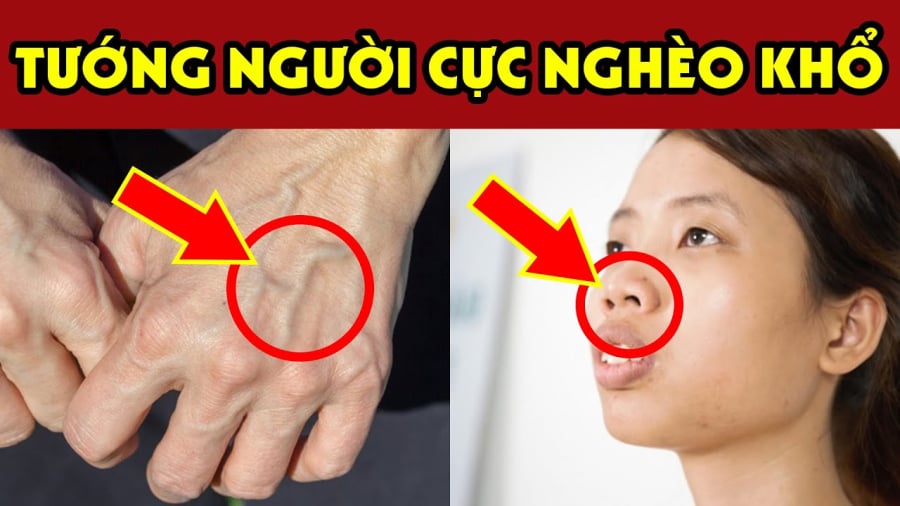 Tướng người nghèo khổ