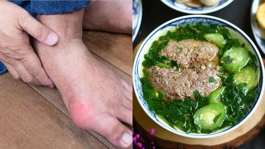 nhom-nguoi-khong-nen-an-rau-mong-toi-la-nguoi-bi-gout