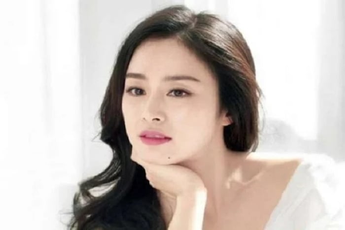 Nốt ruồi ở cằm bên trái biểu thị sự sung túc, phú quý. (Ảnh minh họa)