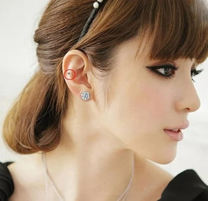 Nốt ruồi ở dái tai bên phải thì nói chung là người rất thông minh, làm việc lý trí, nhân hậu, hiếu thuận với cha mẹ. rất có ích cho chồng. (Ảnh minh họa)