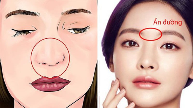 Dấu hiệu cảnh báo bạn sắp phát tài trên mặt