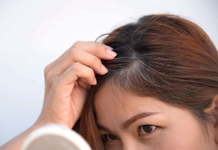 Tóc bạc sớm, ngoài lão hóa, một yếu tố khác mà nhiều người có xu hướng bỏ qua đó là tình trạng thiếu dinh dưỡng. (Ảnh minh họa)
