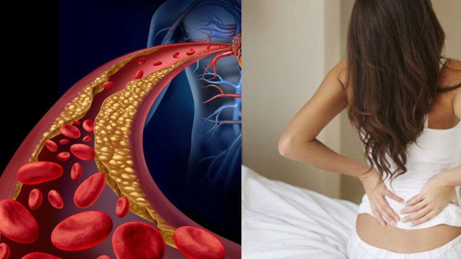 Lối sống chứ không chỉ cân nặng mới ảnh hưởng tới tình trạng mỡ máu