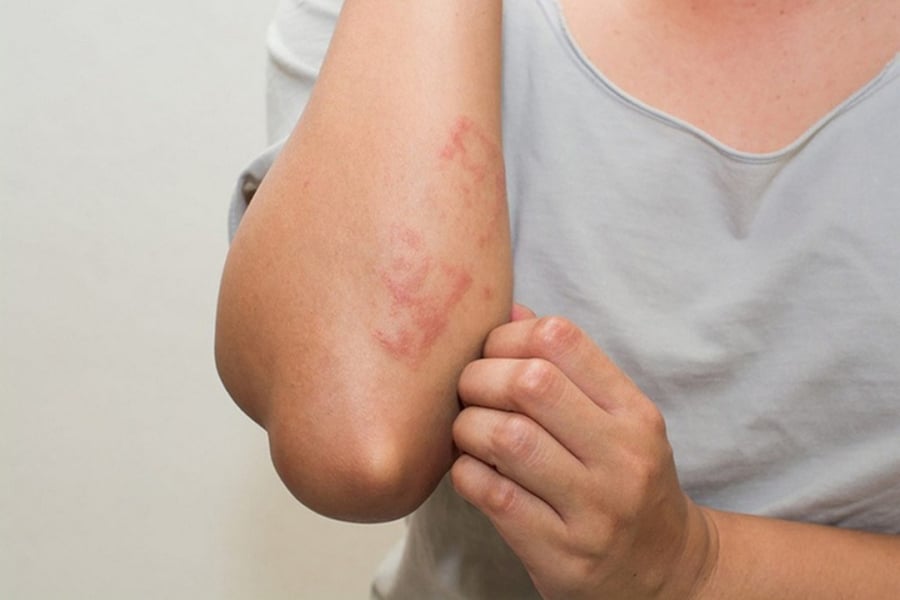 Cảnh báo dấu hiệu bệnh thận