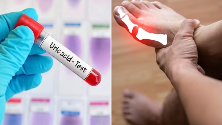 Để hỗ trợ quá trình đào thải axit uric ra khỏi cơ thể, bạn nên uống nhiều nước và những thực phẩm giàu chất xơ.