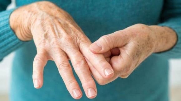 Khi các mạch máu não bị tắc, hệ thần kinh điều khiển vận động sẽ bị ảnh hưởng, khiến tay chân trở nên yếu ớt, khó cử động, hoặc cử động không linh hoạt như bình thường.