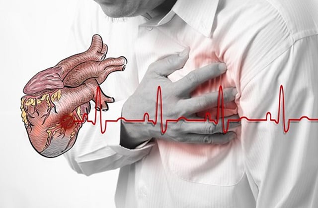 Ông Hoàng Nam Tiến đột ngột qua đời: Cảnh báo biến cố tim đe doạ cả người khoẻ mạnh