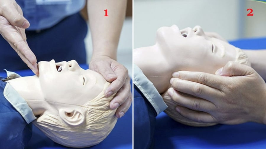Hình 1: Kỹ thuật ngửa đầu, nâng cằm. Hình 2: Kỹ thuật ấn góc hàm.