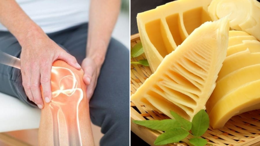 Người bị đau xương khớp không nên ăn măng để tránh làm các cơn đau trở nên nghiêm trọng hơn.
