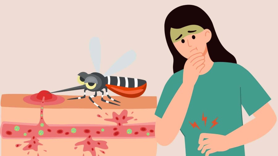 Virus-Chikungunya