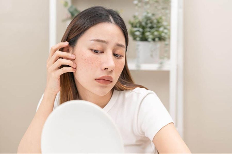 Việc nhận diện những thói quen hằng ngày có thể vô tình khiến tình trạng nặng nám da nặng và kéo dài thời gian phục hồi.