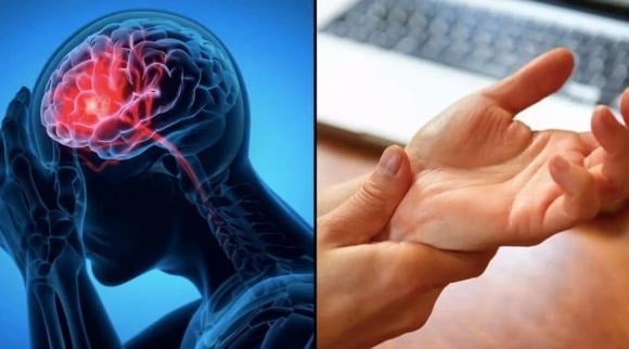 Một số rối loạn đông máu hoặc bệnh mạch máu bẩm sinh.