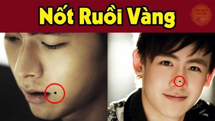 not-ruoi-1315