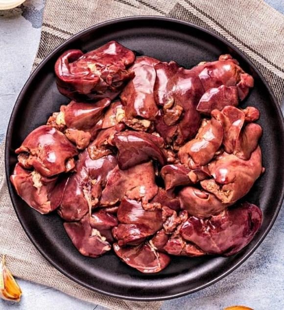 Cholesterol dư thừa tích tụ trong thành mạch, tạo mảng bám gây xơ vữa, khiến động mạch hẹp và cứng lại.