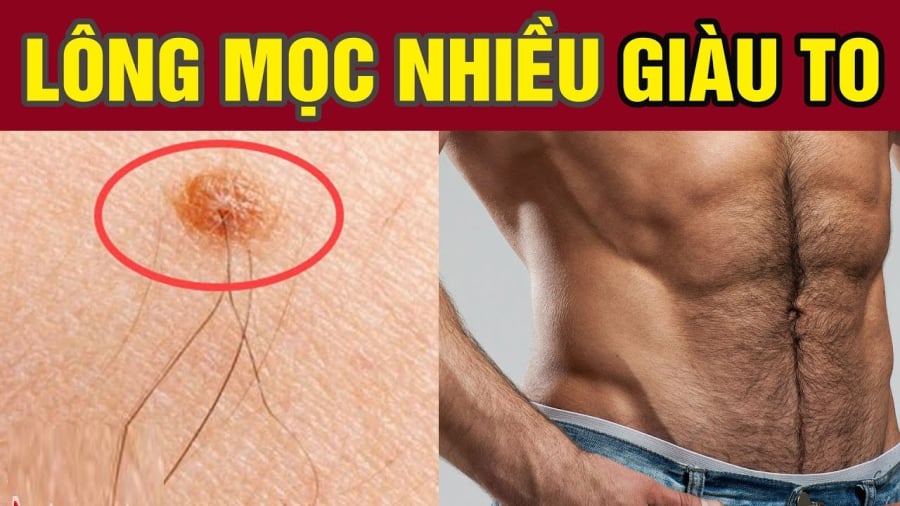 3 chỗ mọc lông Ngồi Không cũng có Tiền, số 1 nhiều người không biết lại nhổ đi