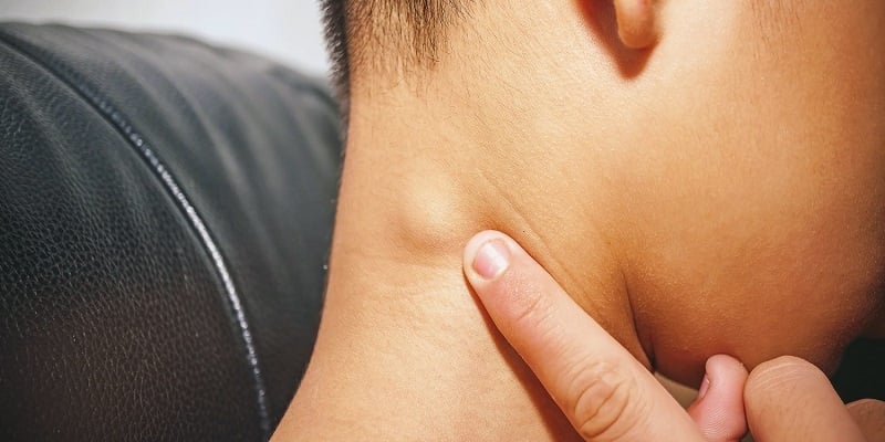 Dấu hiệu cảnh báo bệnh K sớm nên đi khám