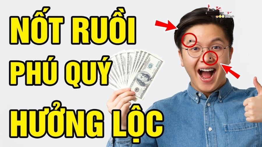 Nốt ruồi thần Tài đánh dấu, ai có 1 cái thôi cả đời chẳng lo thiếu tiền  