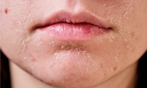 Nội tiết tố ổn định giúp làn da ẩm mượt, căng bóng.