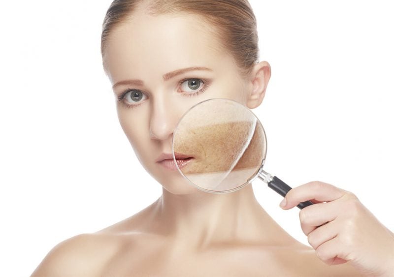 Một loại kem chống nắng quang phổ rộng, SPF từ 30 trở lên, được thoa đều đặn và lặp lại sau vài giờ chính là “vũ khí” cần thiết 