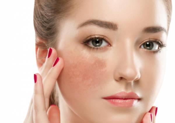 Các thành phần dưỡng ẩm như hyaluronic acid, ceramide, peptide hay panthenol có vai trò duy trì độ ẩm