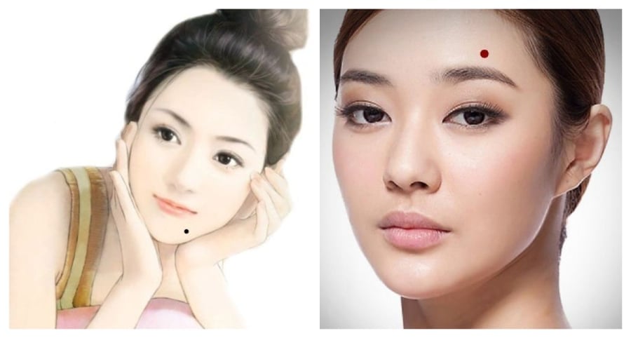 Nốt ruồi phát tài