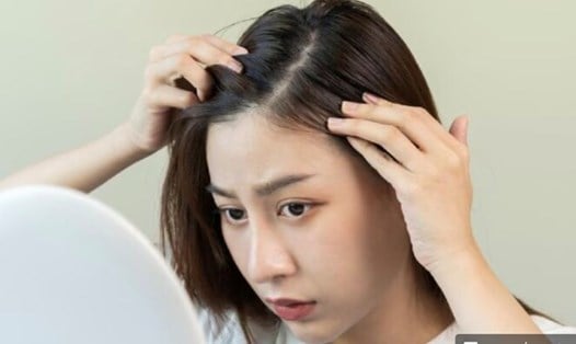 Khi nang tóc suy yếu, tóc sẽ dễ gãy rụng và bạc màu do hoạt động sản xuất melanin bị cản trở.    