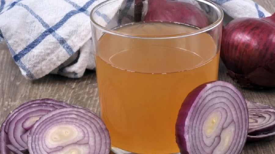 Chợ Việt Có Loại Củ Này Chống Rụng Tóc, Kích Thích Mọc Tóc Cực Nhanh, Nhiều Người Chưa Biết Hành Tây Có Tác Dụng Tốt Trong Việc Giảm Rụng Tóc, Kích Thích Mọc Tóc.
