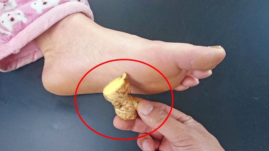 Đắp gừng vào lòng bàn chân mang lại nhiều lợi ích cho sức khỏe.