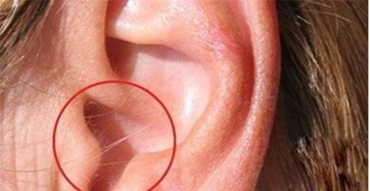 Nếu tai trái của bạn có sợi lông mọc dài hơn bình thường, chắc hẳn bạn là một người có sự nghiệp rất tốt. (Ảnh minh họa)