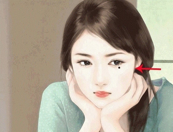 Nốt ruồi kém may mắn