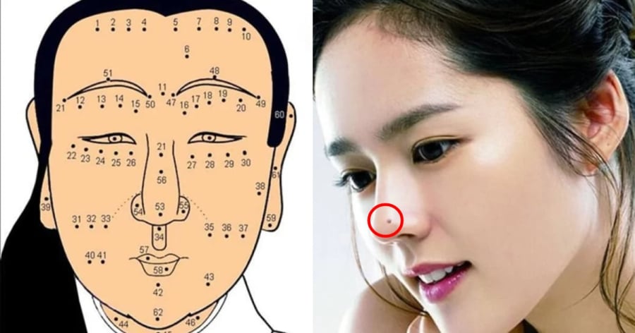 Nốt ruồi chặn cửa thần tài