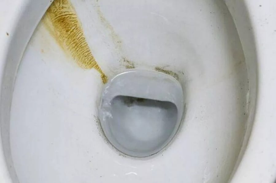 Khi nước bốc hơi, các khoáng chất này kết tủa thành cặn vôi bám trên bề mặt bồn cầu. Ảnh minh họa