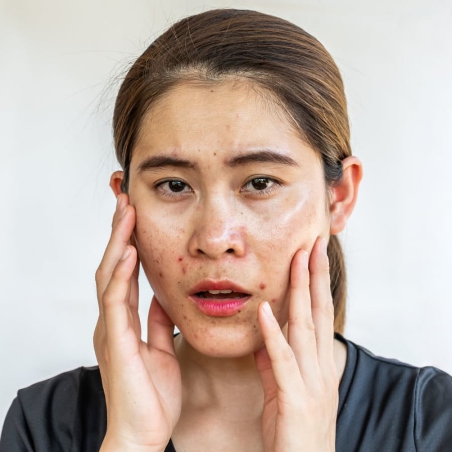 Lớp dầu tự nhiên này giúp hạn chế sự thoát ẩm, giảm ma sát và bảo vệ các tế bào da khỏi khói bụi