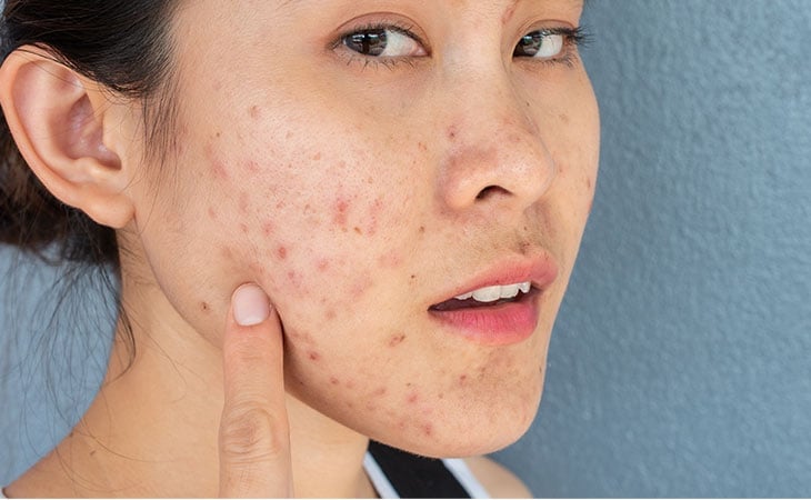 Dù bạn không tiếp xúc quá nhiều với nắng hay bụi mịn, da vẫn có thể trông mệt mỏi, kém đàn hồi 