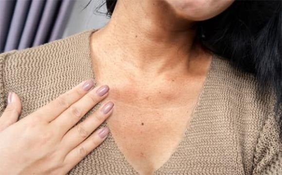 Triệu chứng này càng đáng lo ngại nếu đi kèm mệt mỏi, sụt cân hoặc đau bụng kéo dài. 