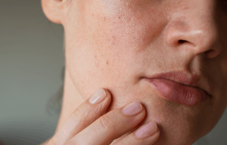 Vào mùa lạnh, nhiều người cũng quên uống đủ nước hoặc chỉ uống khi thấy khát nên cơ thể và làn da thiếu nước trầm trọng.