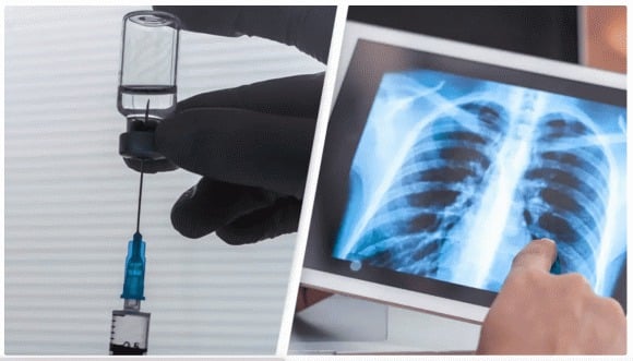 Nếu kết quả thuận lợi, các giai đoạn tiếp theo sẽ mở rộng sang nhóm nguy cơ cao hơn, chẳng hạn như người hút thuốc trong thời gian dài.    