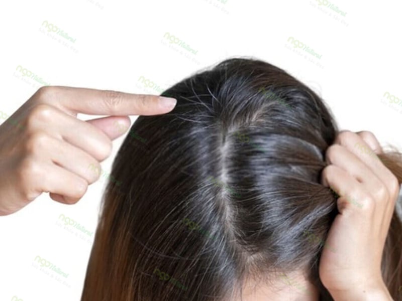 Để hạn chế tình trạng này, đội mũ rộng vành khi ra ngoài nắng là biện pháp đơn giản nhưng hiệu quả. 