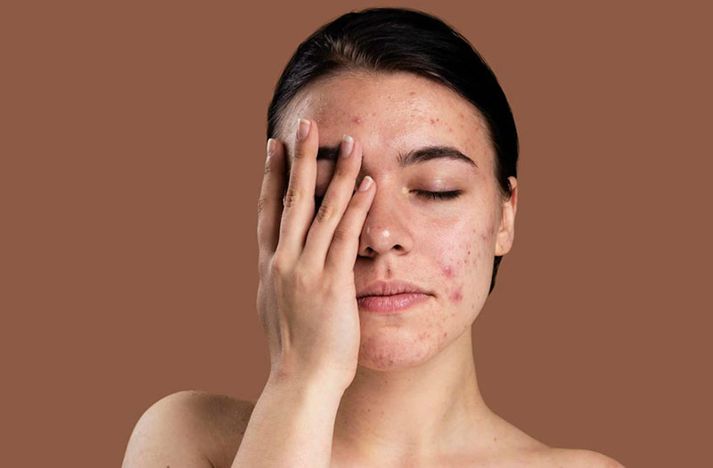 Tẩy tế bào chết là bước hỗ trợ giúp bề mặt da mịn màng và tươi sáng hơn, nhưng khi vượt quá khả năng tái tạo tự nhiên của da, thói quen này lại phản tác dụng