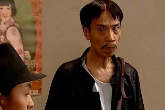 Trong dân gian xưa có câu: “Người hai má hóp thì chớ kết giao”. 