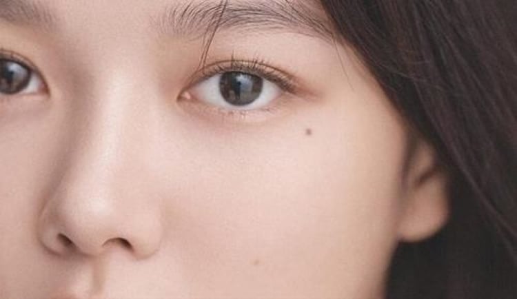 Nốt ruồi ở khóe mắt (Cung phu thê). (Ảnh minh họa)