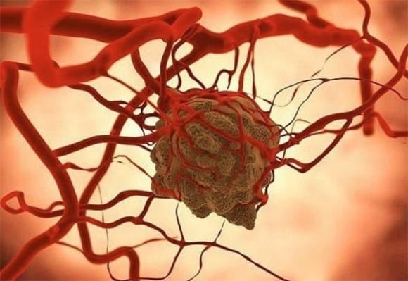 Các chuyên gia cho biết, cơ thể con người tồn tại cơ chế “giám sát miễn dịch”, giúp nhận diện sớm và tiêu diệt những tế bào có dấu hiệu bất thường, bao gồm cả tế bào ung thư. 