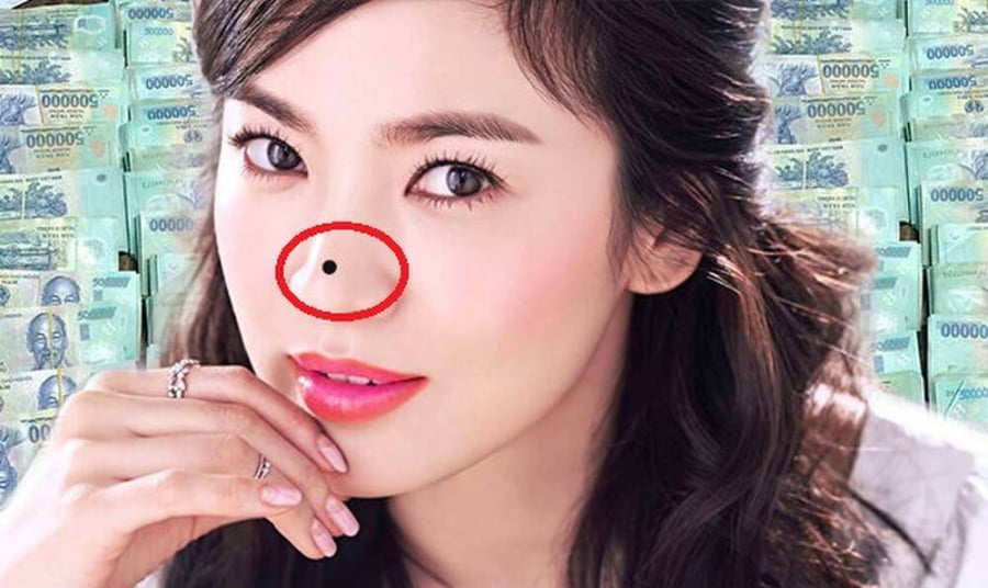 Nốt ruồi gây cản trở tài lộc lận đận tình duyên