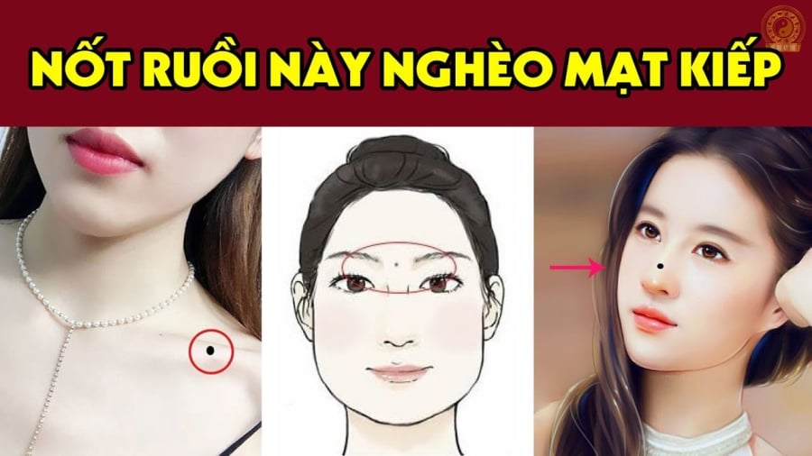 Nṓt ruṑi may mắn