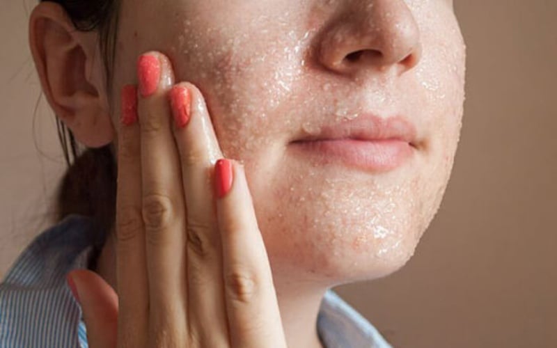 Ngoài ra, thoa muối biển pha đặc lên cơ thể rồi tắm lại bằng nước ấm cũng là cách giúp làn da được thanh lọc nhẹ nhàng. 