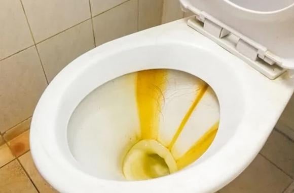 Nhờ đặc tính làm sạch và khử khuẩn, muối rất hữu ích trong việc giặt khăn bông, quần áo trắng bị ố vàng hoặc quần jean cần giữ màu.