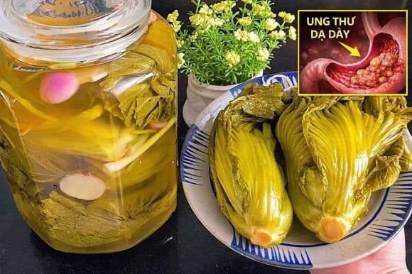 Theo các chuyên gia, việc tiêu thụ dưa muối với tần suất cao và kéo dài là yếu tố nguy cơ đáng lưu ý đối với các bệnh đường tiêu hóa, đặc biệt là ung thư dạ dày.