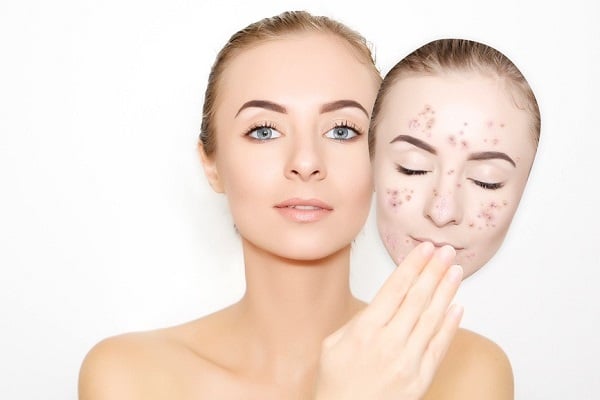 Trong trường hợp cần thiết, liệu trình chăm sóc da chuyên nghiệp như làm sạch sâu hoặc cấp ẩm phục hồi tại cơ sở uy tín có thể hỗ trợ quá trình tái tạo.