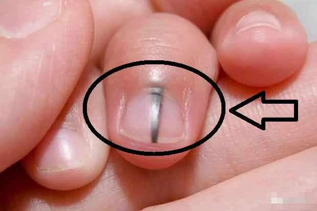 Một số vấn đề về da hoặc móng có thể biểu hiện bằng sự thay đổi màu sắc như vậy.